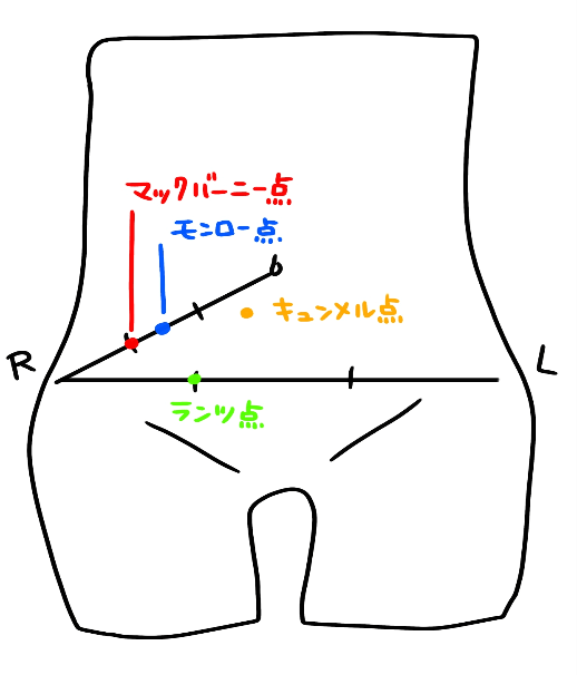 急性虫垂炎