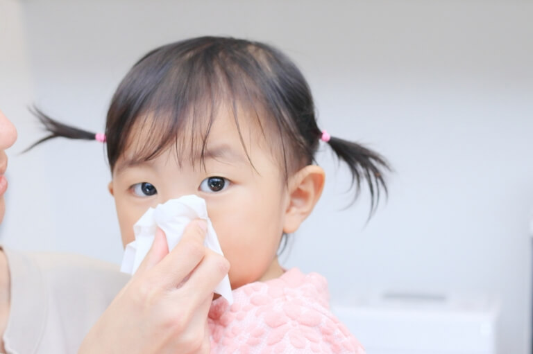 アレルギー性鼻炎、花粉症